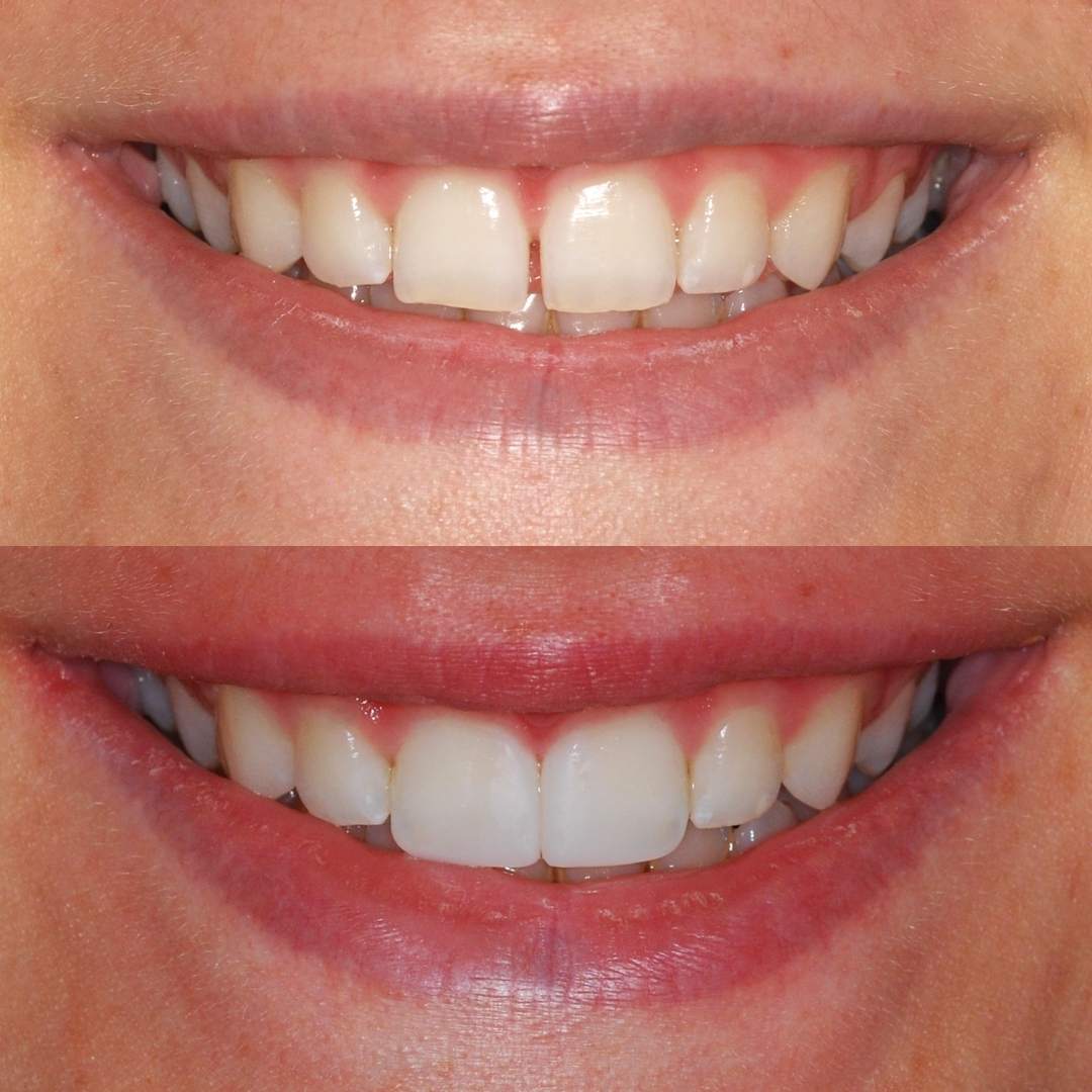 Tuscaloosa General Dentistry