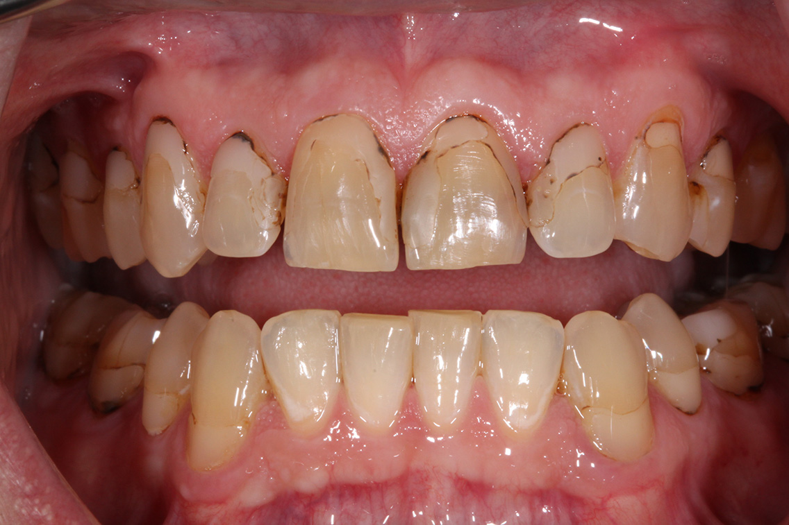 Tuscaloosa General Dentistry Tuscaloosa General Dentistry