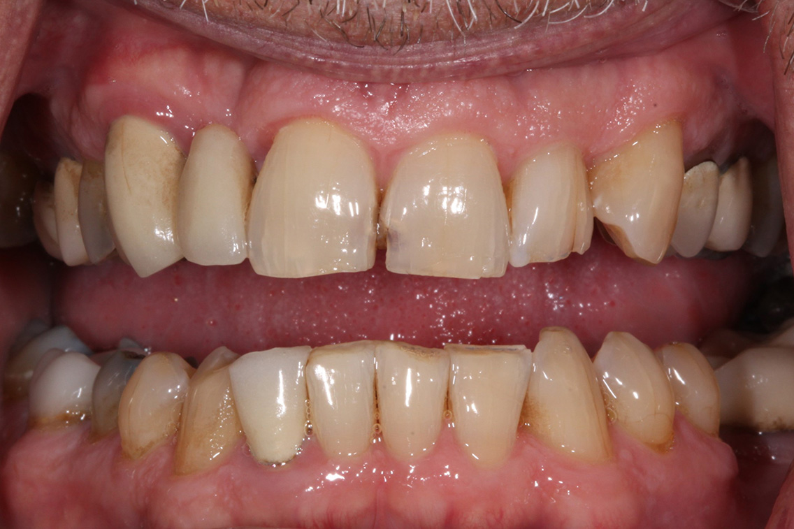 Tuscaloosa General Dentistry Tuscaloosa General Dentistry