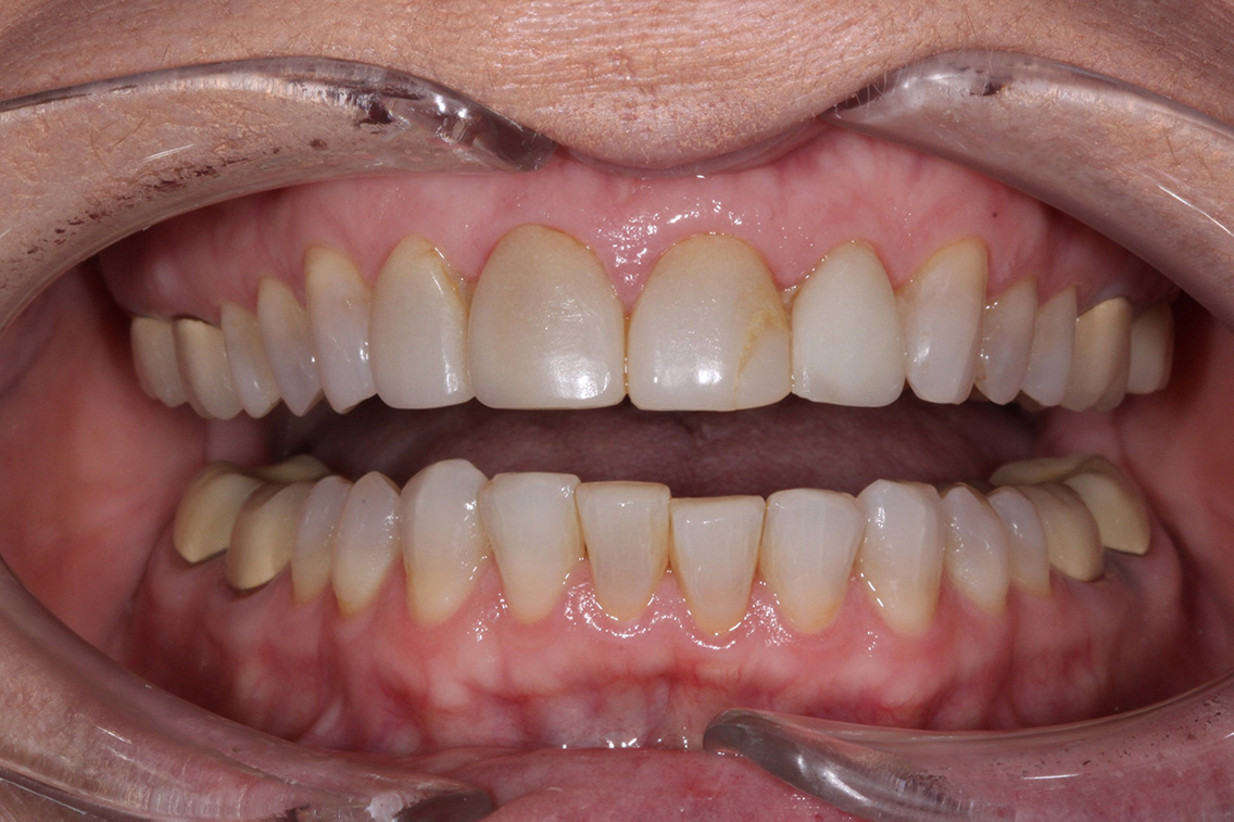 Tuscaloosa General Dentistry Tuscaloosa General Dentistry