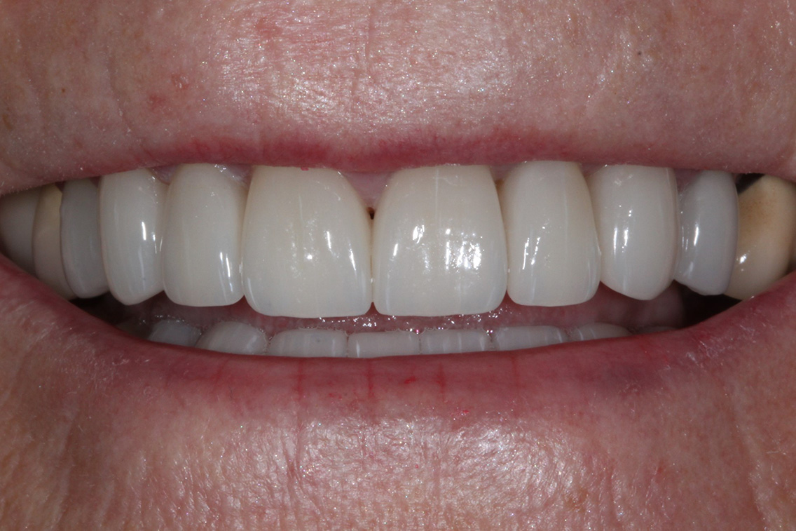 Tuscaloosa General Dentistry Tuscaloosa General Dentistry