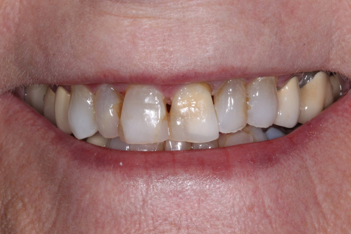 Tuscaloosa General Dentistry Tuscaloosa General Dentistry