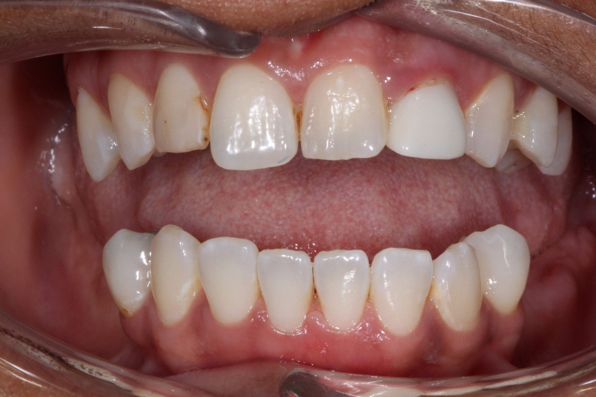 Tuscaloosa General Dentistry Tuscaloosa General Dentistry