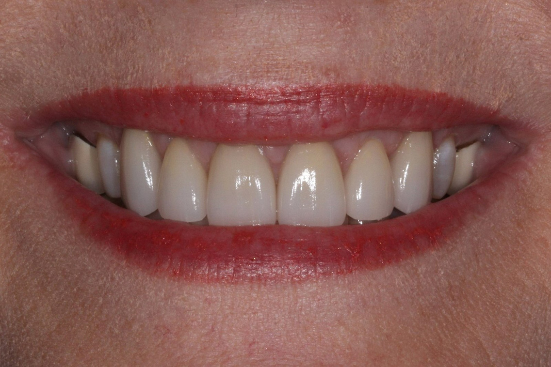 Tuscaloosa General Dentistry Tuscaloosa General Dentistry