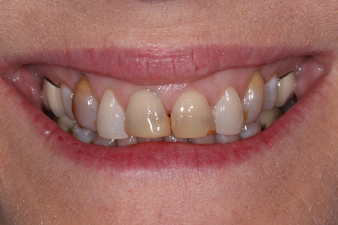 Tuscaloosa General Dentistry Tuscaloosa General Dentistry