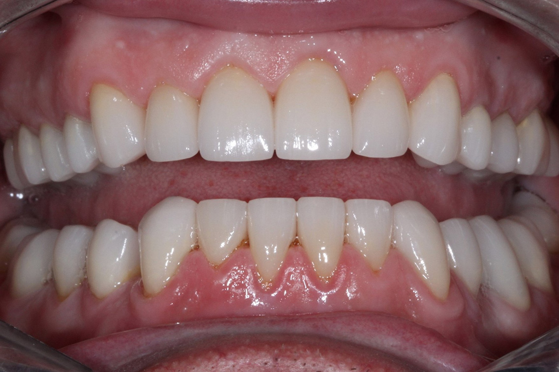 Tuscaloosa General Dentistry Tuscaloosa General Dentistry