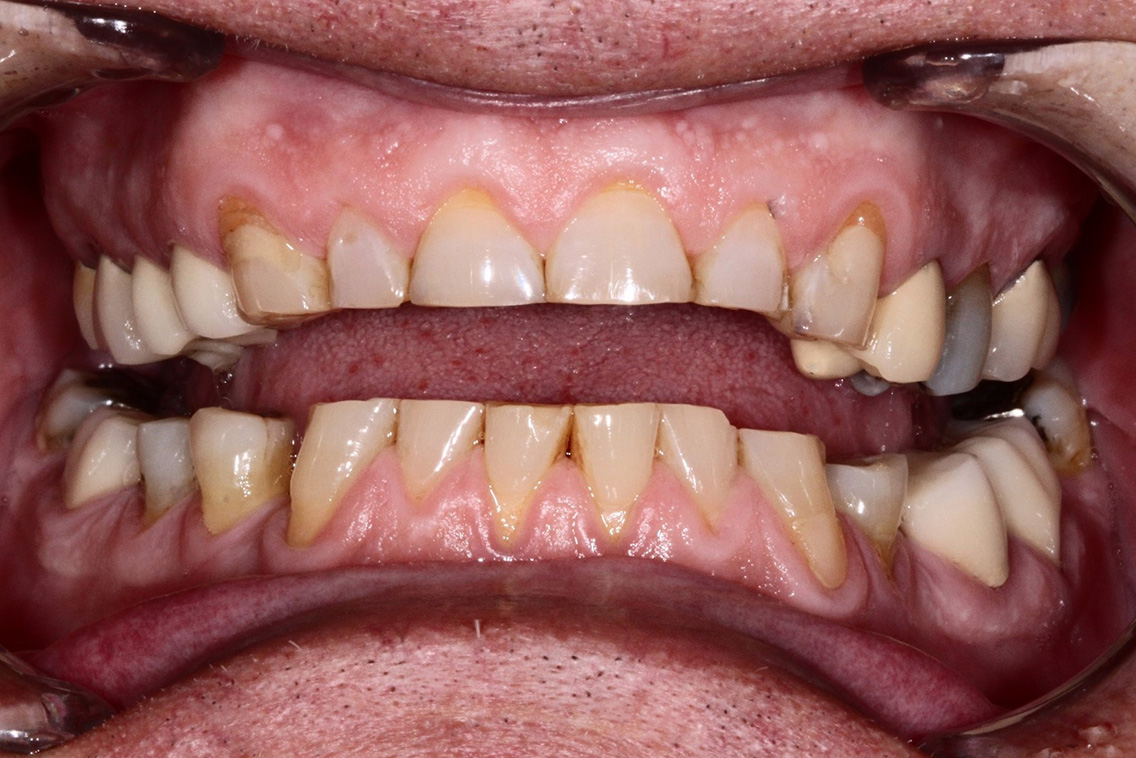 Tuscaloosa General Dentistry Tuscaloosa General Dentistry