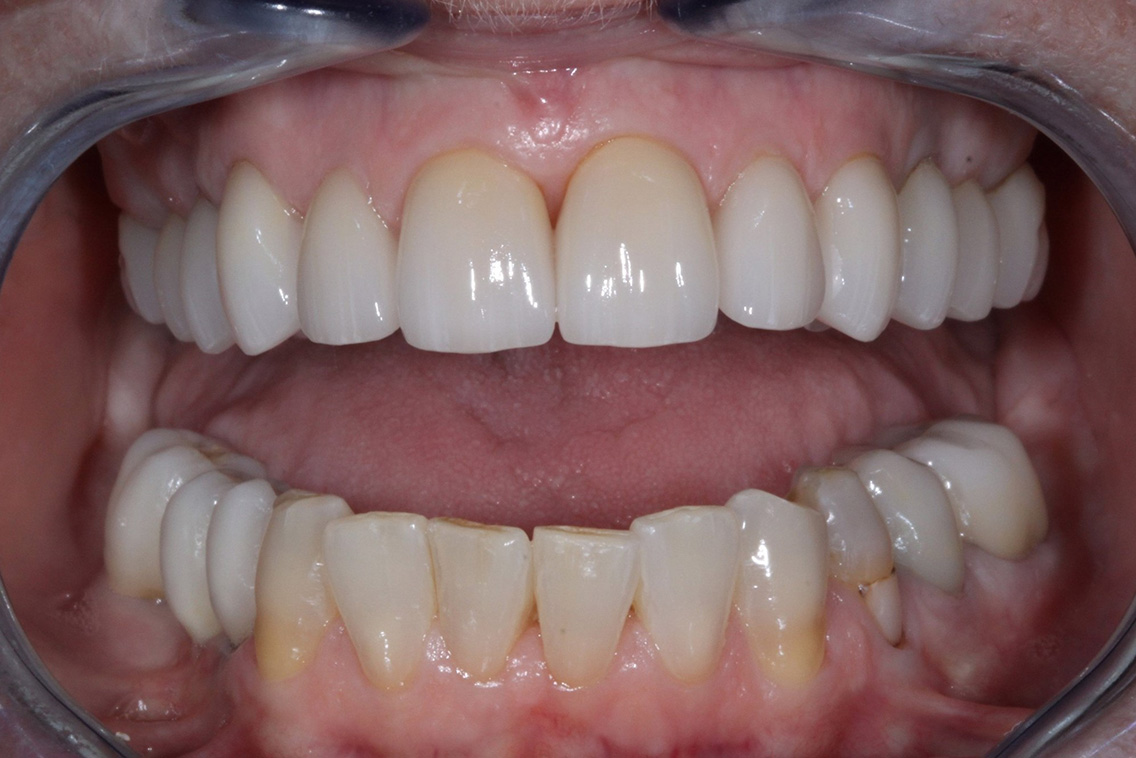 Tuscaloosa General Dentistry Tuscaloosa General Dentistry