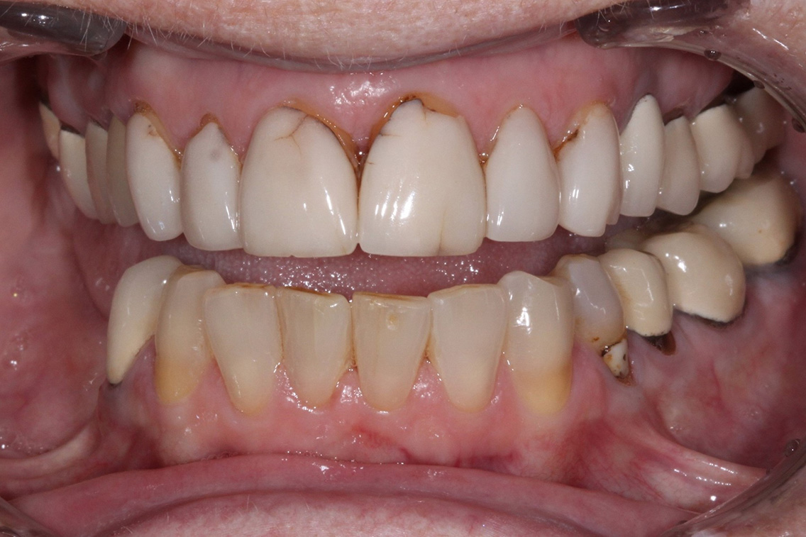 Tuscaloosa General Dentistry Tuscaloosa General Dentistry